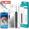 Smart Visual Ear Cleaner HD Ear Sticks Otoscope USB C
